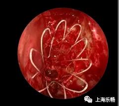 術後.jpg